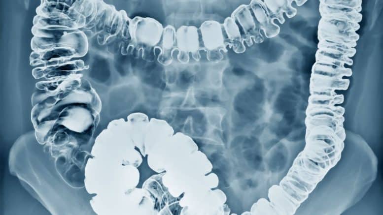 Acute Abdomen: an Approach to Diagnosis and Management - Doctorable