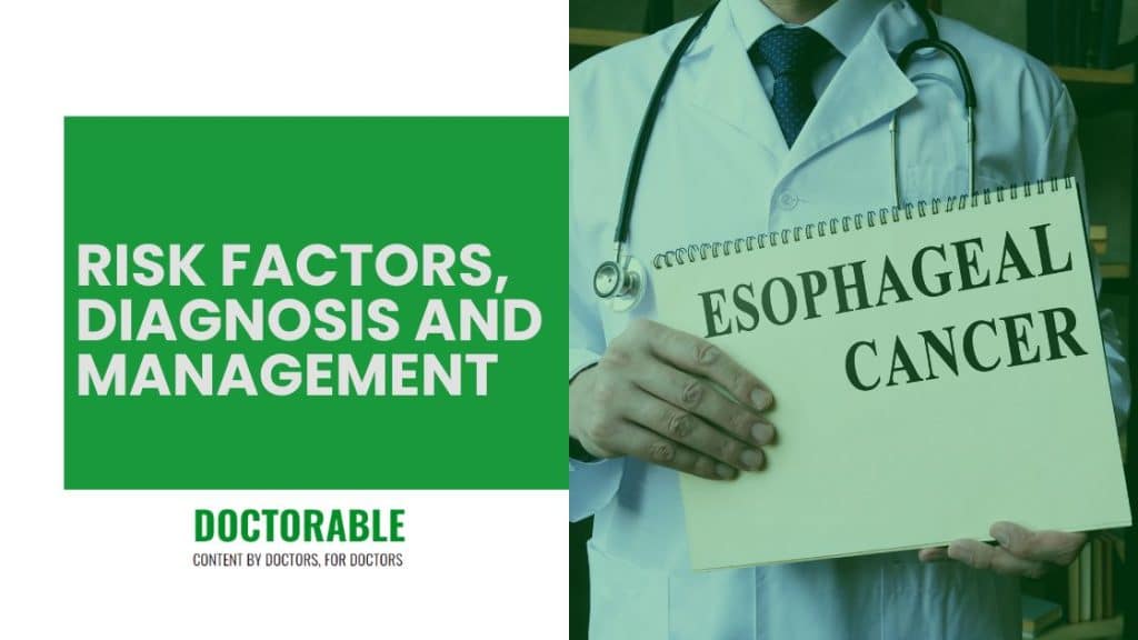 Esophageal Cancer Overview Of Risk Factors Diagnosis And Management Doctorable 1545