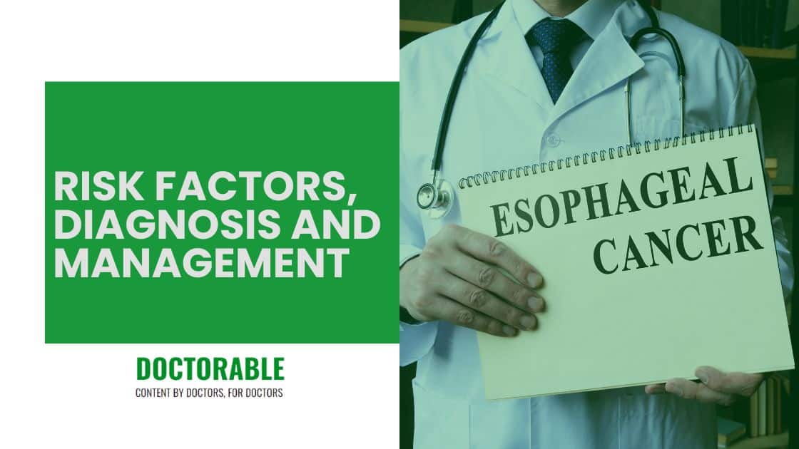 esophageal-cancer-overview-of-risk-factors-diagnosis-and-management