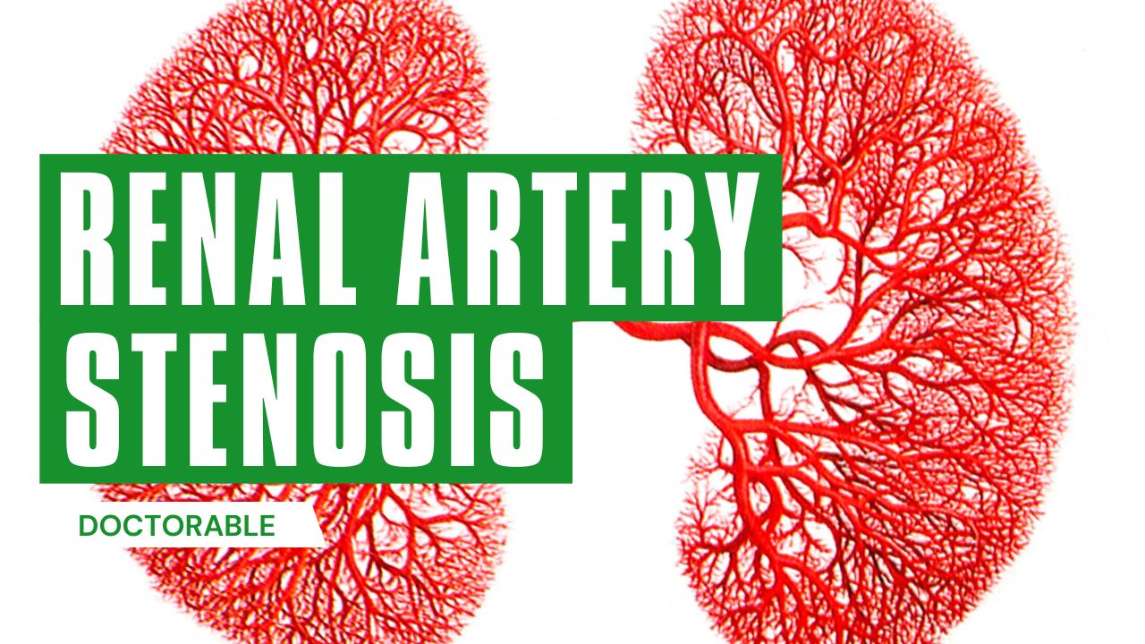 Renal Artery Stenosis | Definition and Overview - Doctorable